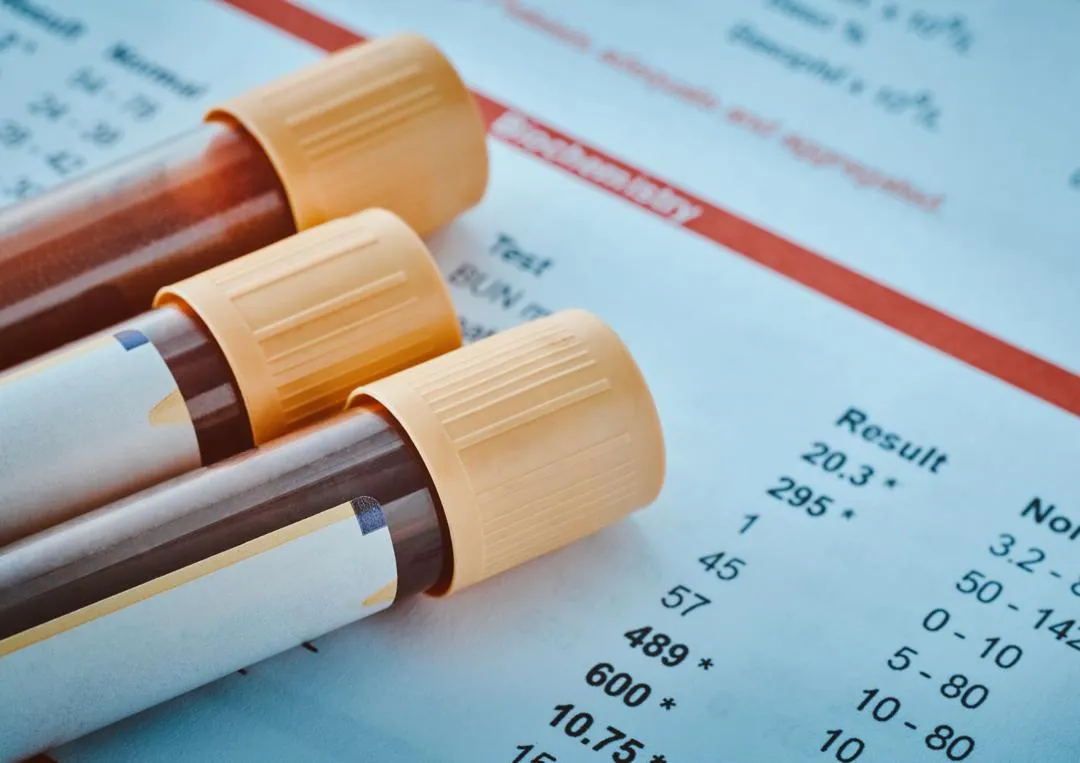 Health Screening & Blood Tests