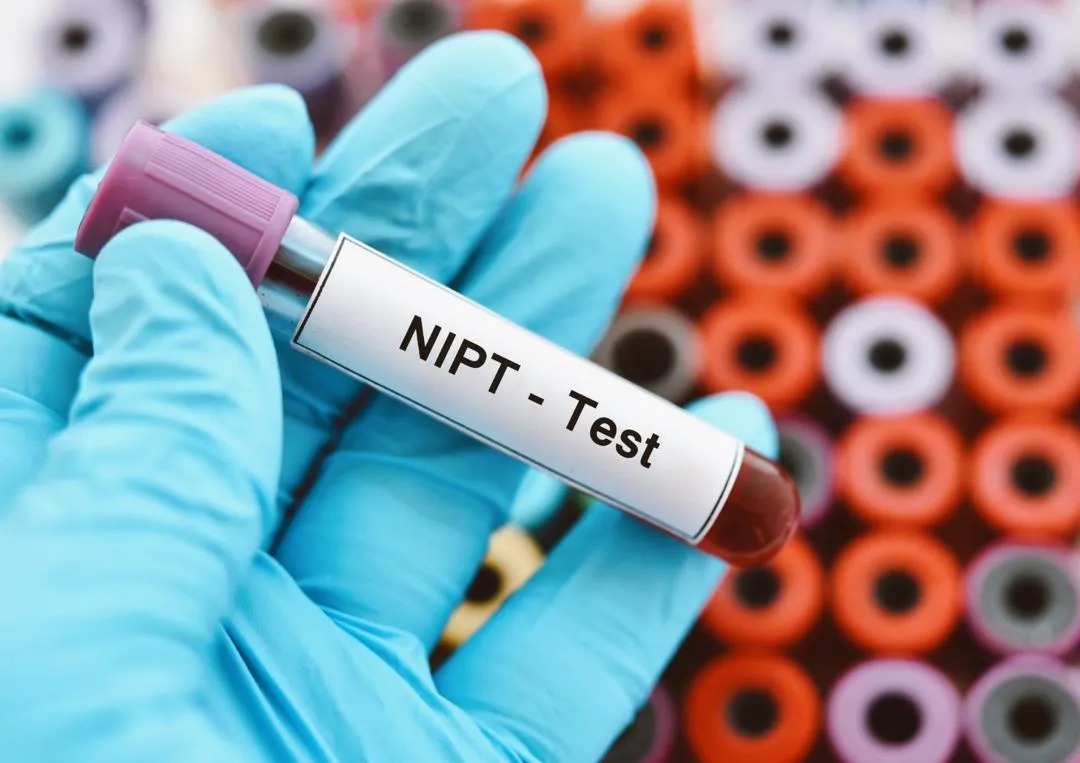 NIPT (Non-Invasive Prenatal Testing)